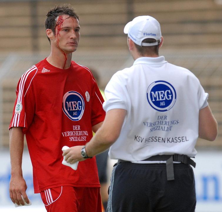 Michael Kümmerle (KSV Hessen Kassel) mit Platzwunde